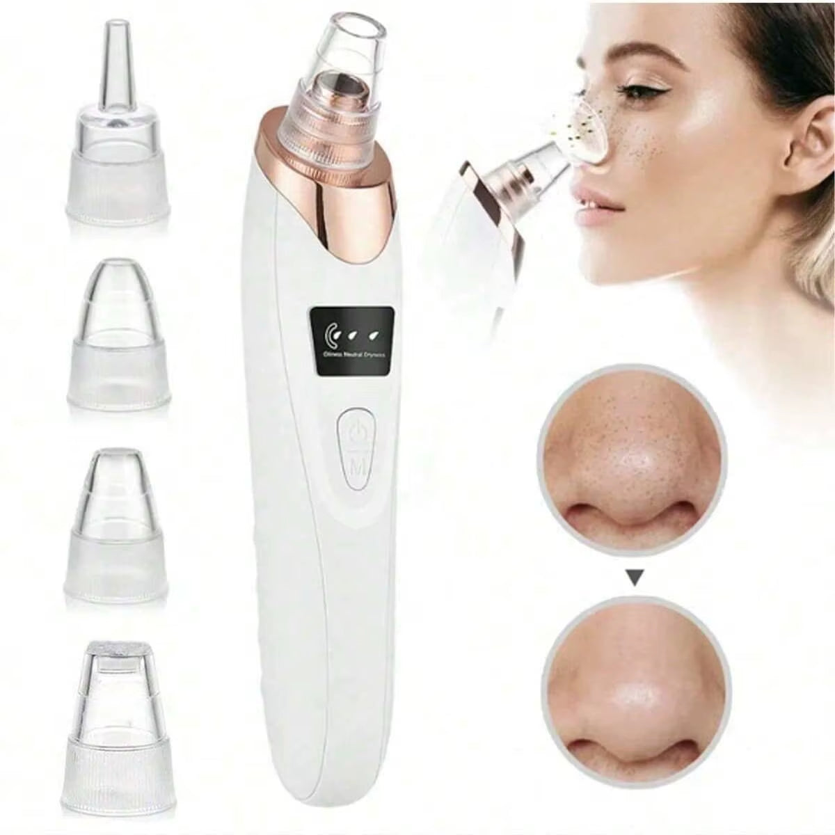 Electric Pore Cleaner & Blackhead Remover